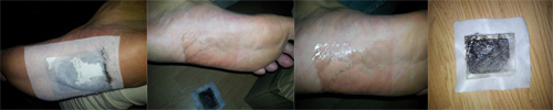 Sorin Plasturi FootPatch